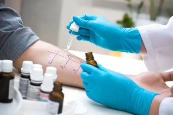 Allergist performing allergy skin test to allergy patient
