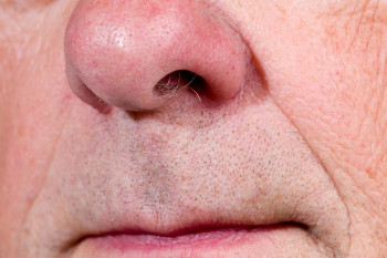 Why does my nose change as I age?